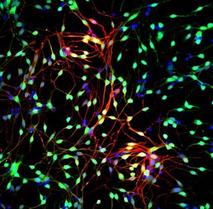 Retinal stem cell-derived photoreceptors